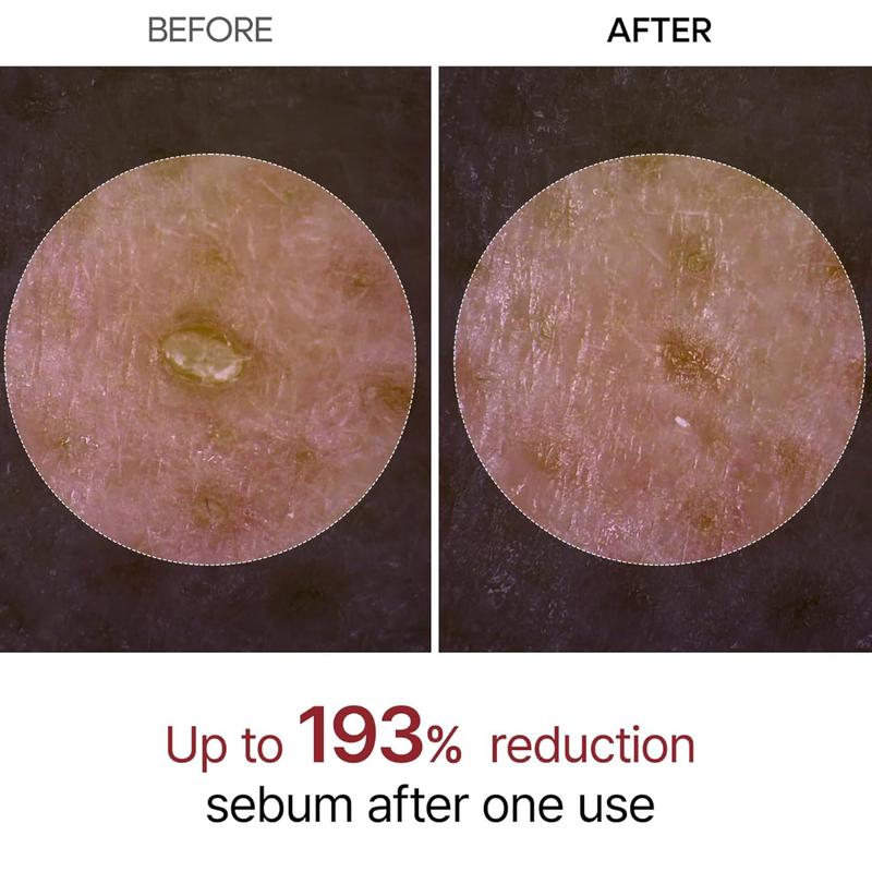 White Rice Exfoliating Ampoule